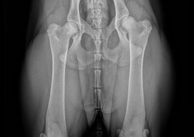 00004168_00076911_DICOM_DX_2025_09_30_0000151442