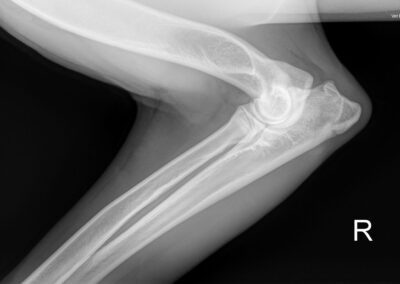 00004168_00076911_DICOM_DX_2025_09_30_0000151445