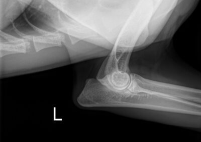 Maze linker elleboog