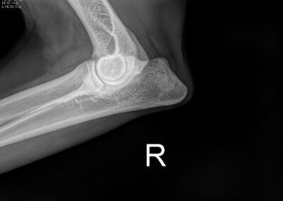 Maze rechter elleboog