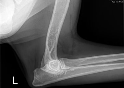 ac315fdf-ba56-4982-97ce-2f44419686f1_00004168_00076831_dicom_dx_2025_09_19_0000151139