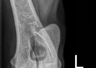 ac315fdf-ba56-4982-97ce-2f44419686f1_00004168_00076831_dicom_dx_2025_09_19_0000151140