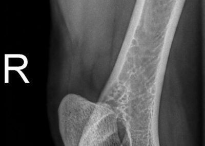 ac315fdf-ba56-4982-97ce-2f44419686f1_00004168_00076831_dicom_dx_2025_09_19_0000151141