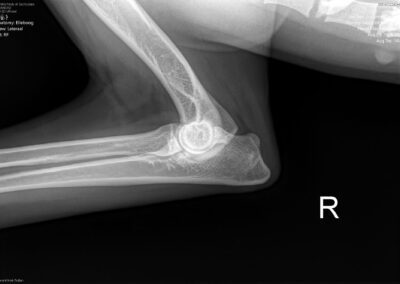 ac315fdf-ba56-4982-97ce-2f44419686f1_00004168_00076831_dicom_dx_2025_09_19_0000151142